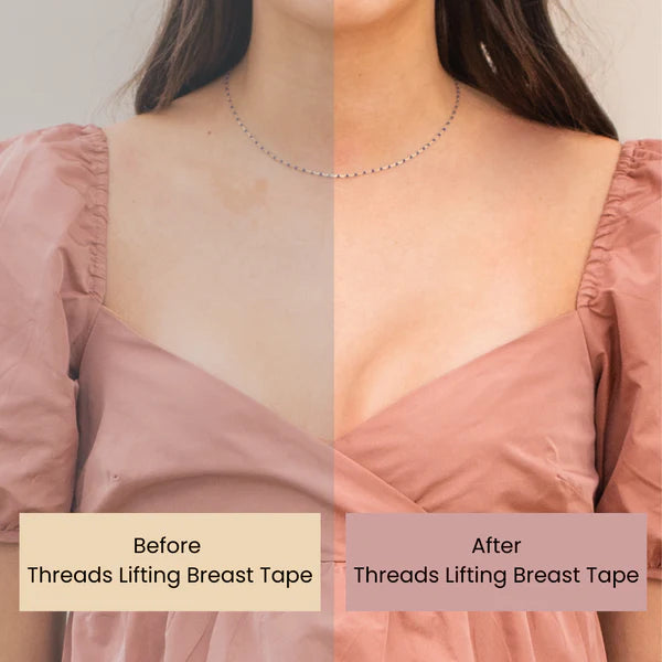 threads Lifting Breast Tape